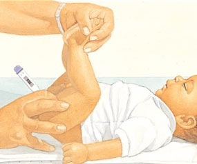 Caretaker hold up babies legs and inserting rectal thermometer.