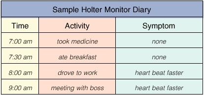 Sample Holter monitor diary, showing a column to record the time, a column for activities, and a column for symptoms.