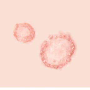 Closeups of lighter and darker skin, showing round patches of ringworm. 