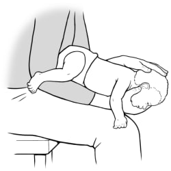 Adult sitting, holding baby face-down on forearm on thigh, with one hand under baby’s chin and other hand on baby’s head.