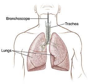 Front view of chest area showing lungs and flexible bronchoscope.