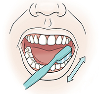 Closeup of mouth showing toothbrush brushing top of lower molars.