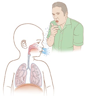 Person coughing and spreading droplets into air and child breathing in droplets.