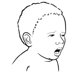 Baby with mouth open, choking.