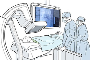 Dos proveedores de atención médica haciendo un cateterismo cardíaco a un niño.