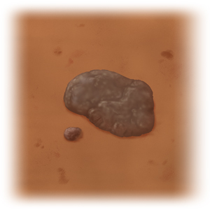 Primer plano de piel con bultos oscuros similares a una verruga.